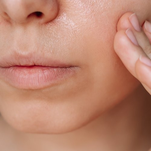Is your skin sensitive…or just sensitised?